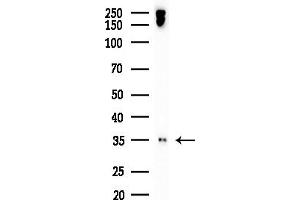 anti-Aquaporin 6, Kidney Specific (AQP6) (Internal Region) antibody
