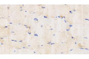 Immunohistochemistry (IHC) image for anti-Interleukin 1, beta (IL1B) (AA 1-266) antibody (ABIN7442414)