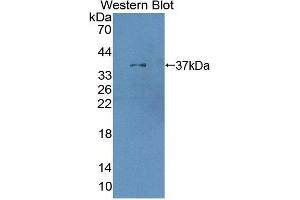 Detection of Recombinant XRN1, Human using Polyclonal Antibody to 5'-3'Exoribonuclease 1 (XRN1) (XRN1 抗体  (AA 1394-1706))