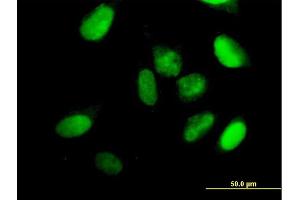 Immunofluorescence of purified MaxPab antibody to KIF22 on HeLa cell. (KIF22 抗体  (AA 1-665))