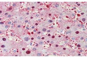 Immunohistochemistry (IHC) image for anti-Serpin Family A Member 7 (SERPINA7) (AA 127-393) antibody (ABIN7429166)