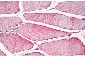 Human Skeletal Muscle: Formalin-Fixed, Paraffin-Embedded (FFPE) (CPNE6 抗体)