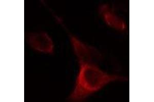 ABIN6275285 staining Hela cells by IF/ICC. (NOX5 抗体  (C-Term))