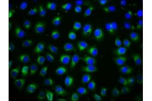 Immunofluorescence staining of A549 cells with ABIN7171846 at 1:133, counter-stained with DAPI. (TSPAN12 抗体  (AA 111-224))