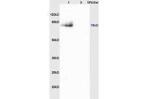 L1 mouse brain lysates L2 mouse heart lysates probed with Anti MMP9 Polyclonal Antibody, Unconjugated (ABIN873171) at 1:200 overnight at 4 °C. (MMP 9 抗体  (AA 151-250))