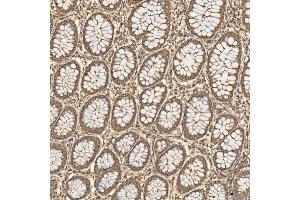 IHC analysis of SNX4 using anti-SNX4 antibody (ABIN7599406).