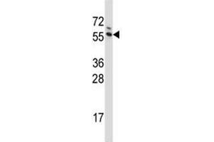 G3BP1 antibody western blot analysis in Jurkat lysate (G3BP1 抗体  (AA 401-430))