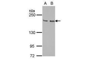 Image no. 1 for anti-Kinesin Family Member 14 (KIF14) (N-Term) antibody (ABIN1494038) (KIF14 抗体  (N-Term))