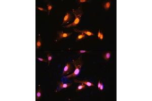 Immunofluorescence analysis of U2OS cells using FLCN antibody (ABIN7267226) at dilution of 1:100. (FLCN 抗体  (AA 1-130))