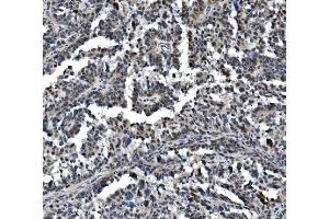 IHC analysis of VPRBP/DCAF1 using anti-VPRBP/DCAF1 antibody (ABIN7599063). (DDB1 and CUL4-Associated Factor 1 (DCAF1) (AA 1-195) 抗体)
