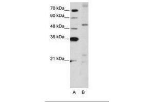 Image no. 1 for anti-Zinc Finger Protein 596 (ZNF596) (AA 424-473) antibody (ABIN203183) (ZNF596 抗体  (AA 424-473))