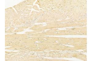 ABIN6266027 and ABIN6267216 at 1/100 staining human tongue carcinoma by IHC-P. (WIPI2 抗体  (C-Term))