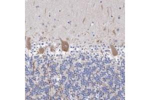 Immunohistochemical staining of human cerebellum with TANC1 polyclonal antibody  shows moderate cytoplasmic positivity in Purkinje cells. (TANC1 抗体)
