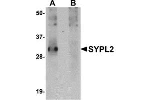 Western Blotting (WB) image for anti-Synaptophysin-Like 2 (SYPL2) (C-Term) antibody (ABIN1030718) (SYPL2 抗体  (C-Term))