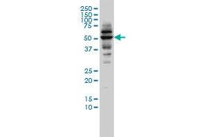 CAP2 monoclonal antibody (M01), clone 3G9-1A5 Western Blot analysis of CAP2 expression in C32 . (CAP2 抗体  (AA 1-477))