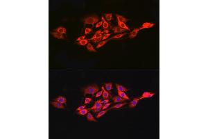 Immunofluorescence analysis of PC-12 cells using IL15RA Rabbit pAb (ABIN3017117, ABIN1680439 and ABIN7101500) at dilution of 1:100 (40x lens). (IL15RA 抗体  (AA 31-205))