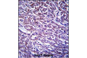 XIRP1 Antibody (C-term) (ABIN657535 and ABIN2846553) immunohistochemistry analysis in formalin fixed and paraffin embedded human heart tissue followed by peroxidase conjugation of the secondary antibody and DAB staining.