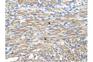 MBNL1 antibody was used for immunohistochemistry at a concentration of 4-8 ug/ml to stain Myocardial cells (arrows) in Human Liver. (MBNL1 抗体)