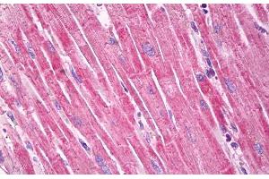 ABIN571179 (5µg/ml) staining of paraffin embedded Human Heart. (Dystroglycan 抗体  (Internal Region))