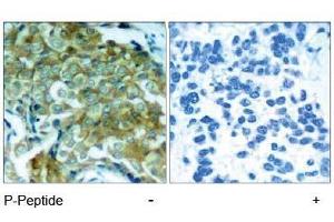 Image no. 1 for anti-Epidermal Growth Factor Receptor (EGFR) (pTyr1172) antibody (ABIN196960) (EGFR 抗体  (pTyr1172))