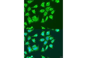 Immunofluorescence analysis of U2OS cells using MCCC2 antibody  at dilution of 1:100. (MCCC2 抗体  (AA 284-563))