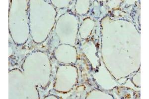 Immunohistochemistry of paraffin-embedded human thyroid tissue using ABIN7144163 at dilution of 1:100 (ANKMY1 抗体  (AA 1-220))