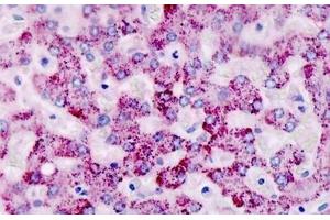 Human, Liver: Formalin-Fixed Paraffin-Embedded (FFPE) (CAPNS2 抗体  (AA 55-83))