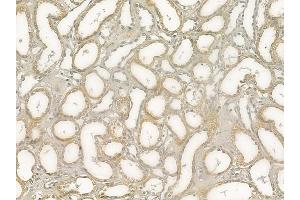 ABIN6259710 and ABIN6278976 at 1/100 staining human normal kidney tissue by IHC-P. (ACAA2 抗体  (Internal Region))