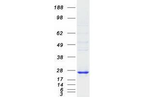 Western Blotting (WB) image for Dual Specificity Phosphatase 14 (DUSP14) protein (Myc-DYKDDDDK Tag) (ABIN2719829)