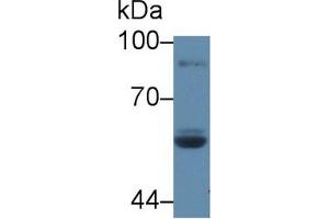 Western blot analysis of Human Saliva, using Rat LPO Antibody (5 µg/ml) and HRP-conjugated Goat Anti-Rabbit antibody ( (LPO 抗体  (AA 351-589))