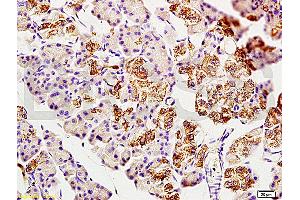 Immunohistochemistry (IHC) image for anti-2',3'-Cyclic Nucleotide 3' phosphodiesterase (CNP) (AA 151-250) antibody (ABIN730738) (Cnpase 抗体  (AA 151-250))