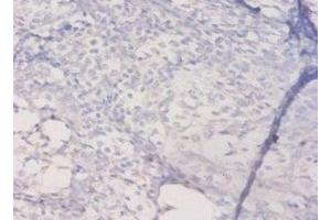 Immunohistochemistry of paraffin-embedded human prostate tissue using ABIN7155589 at dilution of 1:50 (HLA-DQA1 抗体  (AA 24-213))