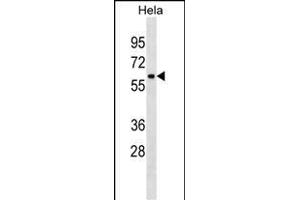 ZN Antibody (C-term) (ABIN1882025 and ABIN2838410) western blot analysis in Hela cell line lysates (35 μg/lane). (ZNF410 抗体  (C-Term))