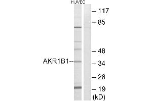Western blot analysis of extracts from HUVEC cells, using AKR1B1 antibody. (AKR1B1 抗体)