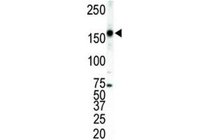 Western blot analysis of ERBB4 antibody and T47D cell lysate.