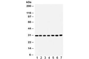 Western blot testing of 1) rat brain, 2) rat liver, 3) rat kidney, 4) mouse brain, 5) Jurkat, 6) CEM and 7) HeLa lysate with COMT antibody. (COMT 抗体  (AA 52-271))