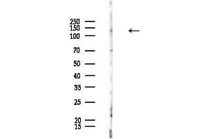 anti-Cell Division Cycle Associated 2 (CDCA2) (Internal Region) antibody