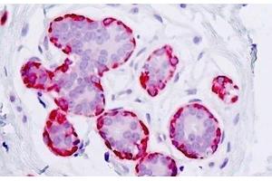 Immunohistochemistry (IHC) image for anti-Kallikrein B, Plasma (Fletcher Factor) 1 (KLKB1) (AA 341-390), (Cleaved-Arg390) antibody (ABIN2879288)