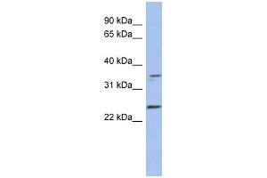 NDN antibody used at 1 ug/ml to detect target protein. (NDN 抗体)