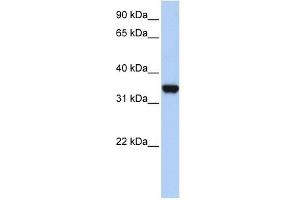LDHA antibody used at 1 ug/ml to detect target protein. (Lactate Dehydrogenase A 抗体  (Middle Region))