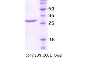 Figure annotation denotes ug of protein loaded and % gel used. (NCR/Nkp46 蛋白)