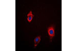 Immunofluorescent analysis of Cytochrome P450 3A4/5 staining in HepG2 cells. (Cytochrome P450 3A4, 3A5 (Center) 抗体)