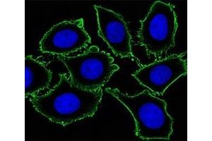 Immunofluorescence (IF) image for anti-Mast/stem Cell Growth Factor Receptor (KIT) antibody (ABIN3028783)