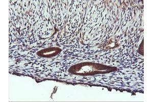 Image no. 2 for anti-Phosphatidylinositol-4-Phosphate 3-Kinase, Catalytic Subunit Type 2 beta (PIK3C2B) antibody (ABIN1500199)