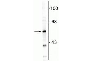 Western blot of rat cortical lysate showing specific immunolabeling of the ~50 kDa GFAP protein. (GFAP 抗体)