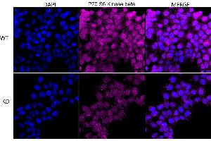 Immunocytochemical staining of HeLa cells using P70 S6 Kinase beta antibody (ABIN7800226), 1:1,000), Top panel: wild-type (WT), Bottom panal: P70 S6 Kinase beta shRNA knockdown (KD). (Recombinant RPS6KB2 抗体)