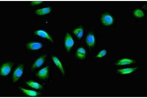 Immunofluorescent analysis of Hela cells using ABIN7153133 at dilution of 1:100 and Alexa Fluor 488-congugated AffiniPure Goat Anti-Rabbit IgG(H+L) (FHL2 抗体  (AA 112-233))
