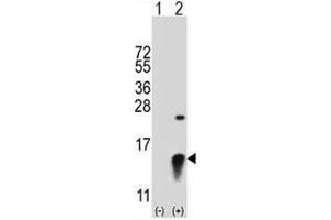 Western blot analysis of SUMO2 antibody and 293 cell lysate (2 ug/lane) either nontransfected (Lane 1) or transiently transfected (2) with the SUMO2 gene. (SUMO2 抗体  (AA 63-93))