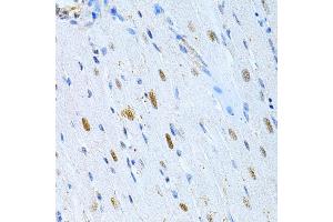 Immunohistochemistry (IHC) image for anti-Microtubule-Associated Protein 2 (MAP2) (AA 260-559) antibody (ABIN3016265)