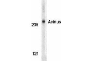 Western blot analysis of Acinus in K562 whole cell lysate with AP30012PU-N Acinus antibody (IN) at 1 μg/ml. (ACIN1 抗体  (Intermediate Domain))